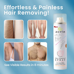New Ecrin Hair Removal Foaming Spray - Advance Formula with Refreshing Fragrance (200ml)