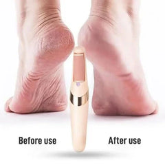 Electric Foot Callus Remover – Pedicure File for Cracked Heels
